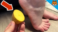 Rub a Potato on your Feet and WATCH WHAT HAPPENS(Genius Trick)